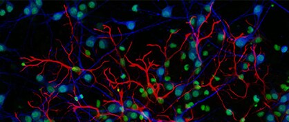 Technological Advancements in Fluorescence Microscopy